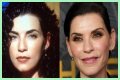 Julianna Margulies Doesn’t Look Natural After Plastic Surgery!